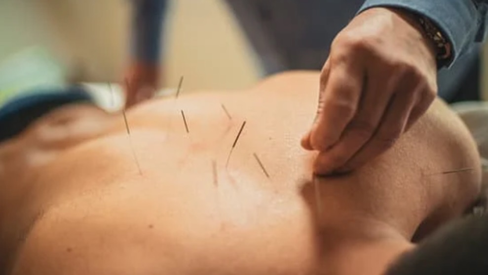 Acupuncture in Pain Management